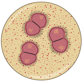 Trichomonas és gonococcus)