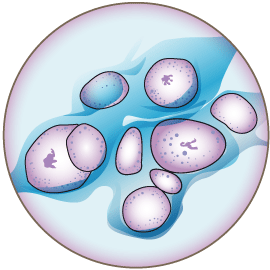 Chlamydia trachomatis